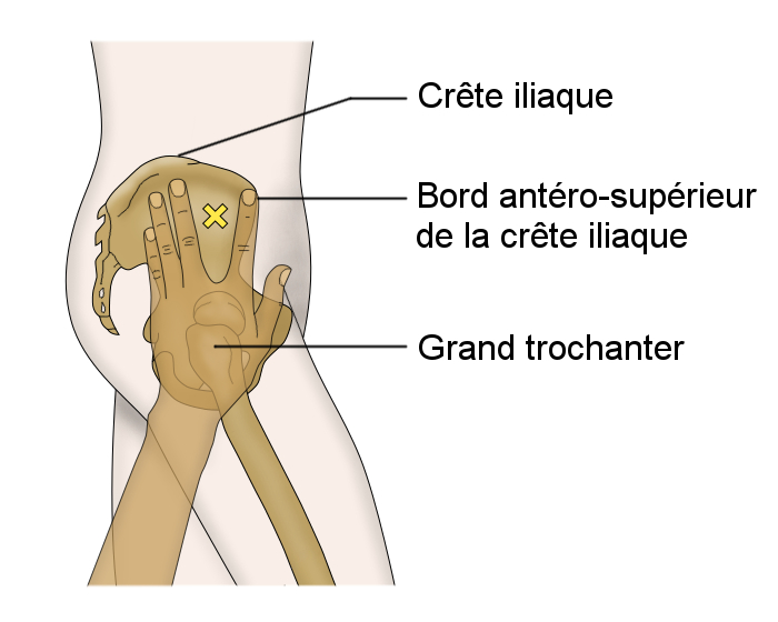 Muscle fessier antérieur